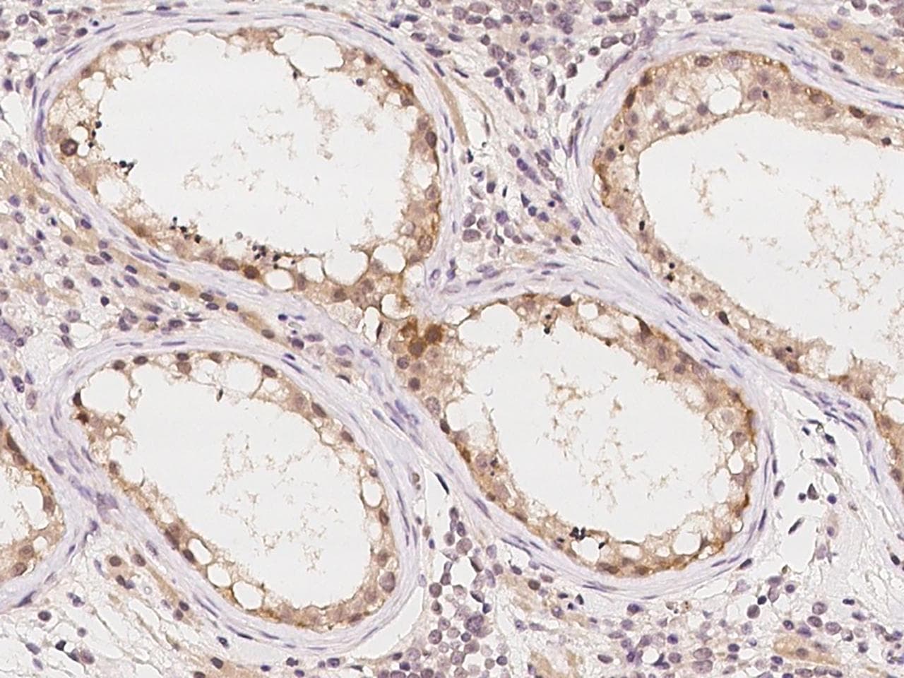 E6AP / UBE3A Antibody