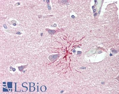 IHC-plus™ Polyclonal Rabbit anti-Human SLC8A3 / NCX3 Antibody (IHC)
