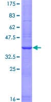 Human DBNDD2 Protein (Recombinant GST)