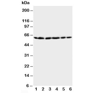 HSPD1 / HSP60 Antibody (aa503-516)
