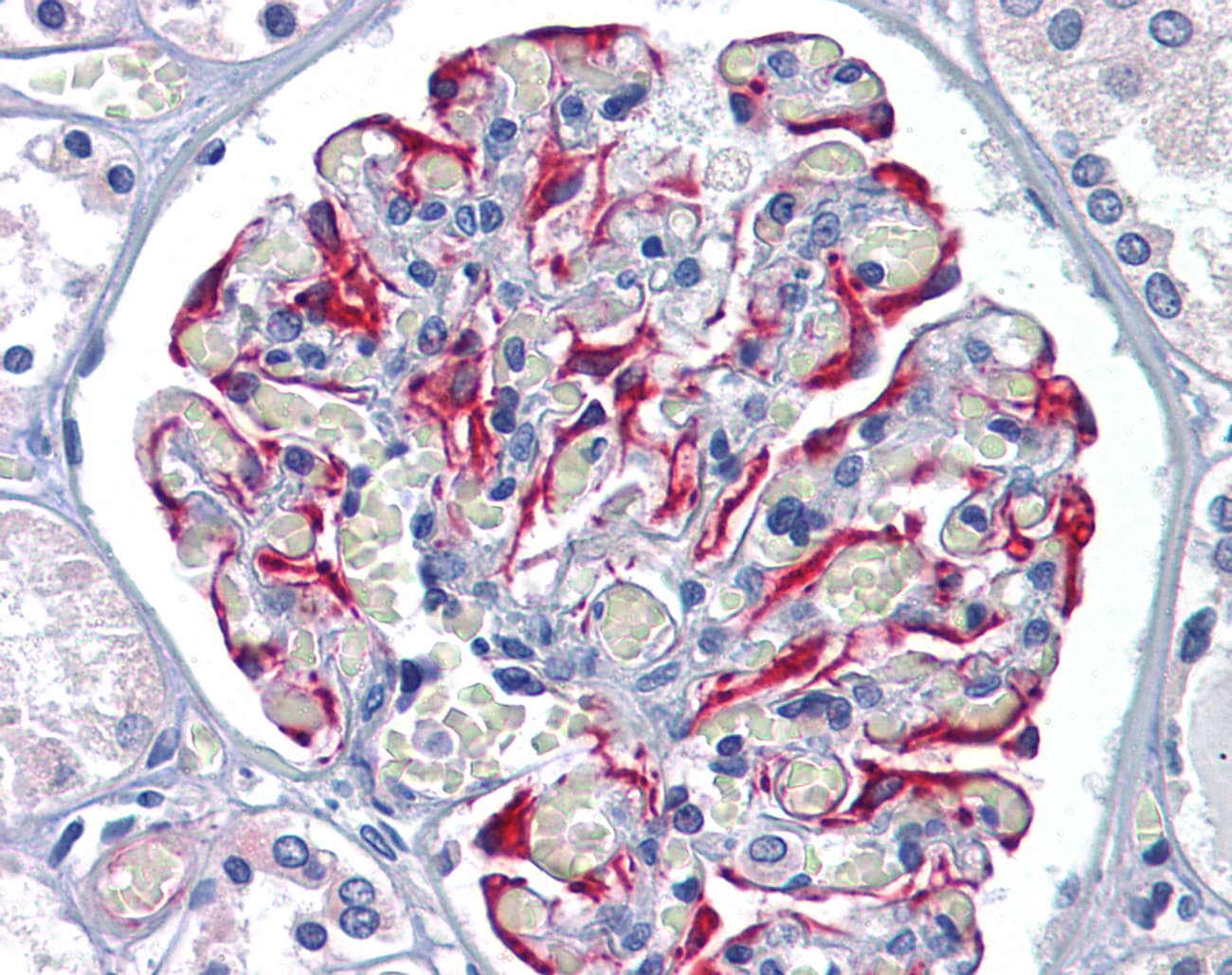 IHC-plus™ GFPT1 / GFAT Antibody (C-Terminus)