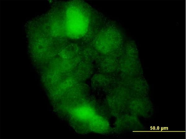 IHC-plus™ CSTB / Cystatin B / Stefin B Antibody (clone M2F1)