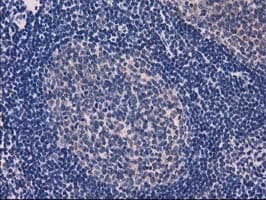 EIF4E2 / IF4e Antibody (clone OTI1F11)