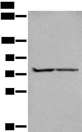 Polyclonal Rabbit anti-Human ALKBH8 Antibody (IHC, WB)