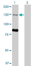 MTMR3 Antibody (clone 1E11)