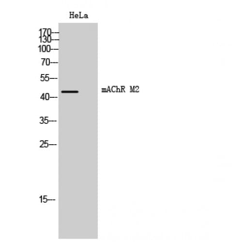 Polyclonal Rabbit anti-Human CHRM2 / M2 Antibody (160-240 aa, Internal, IF, WB)