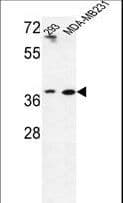 MAT2B Antibody (aa80-107)