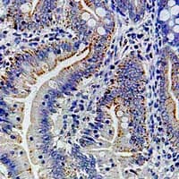 Polyclonal Rabbit anti-Human RPN1 / Ribophorin I Antibody (IHC, WB)