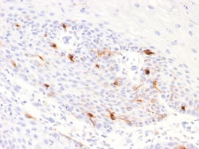 TYRP1 / gp75 Antibody (aa 257-377, clone TYRP1/2340R)