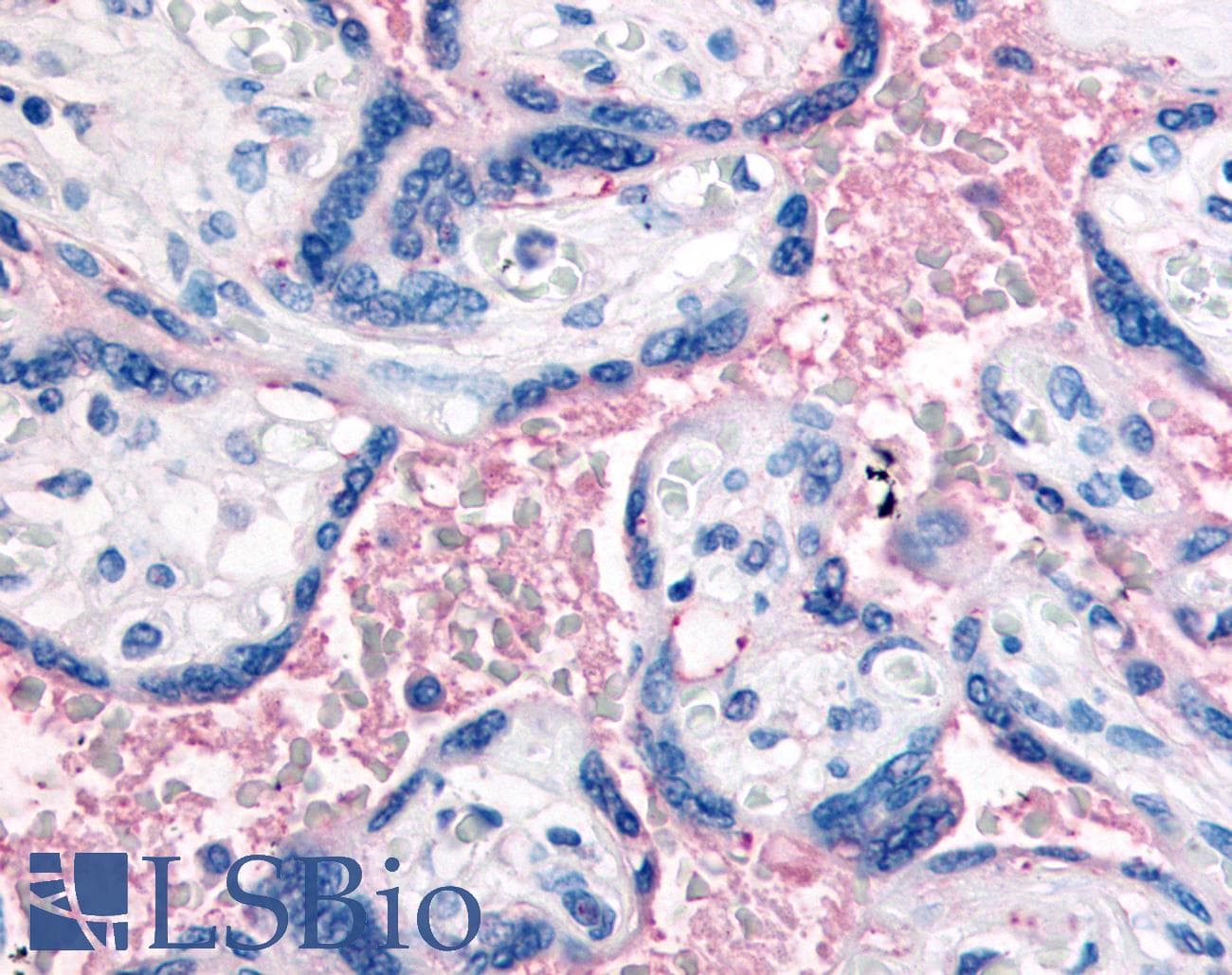 IHC-plus™ ITGB3 / Integrin Beta 3 / CD61 Antibody (N-Terminus)