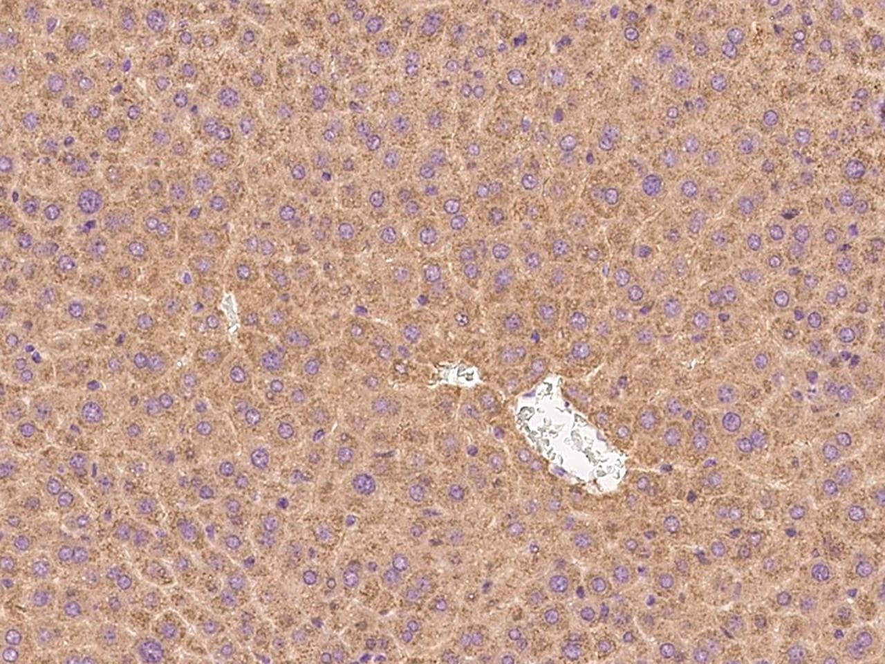 F9 / Factor IX Antibody