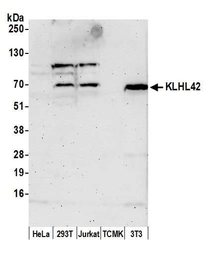 KLHL42 / KLHDC5 Antibody (aa400-450)