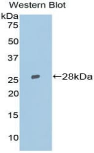 TOP2B / Topoisomerase II Beta Antibody (aa446-655, Biotin)