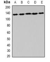 AARS Antibody