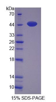 Human MYPN Protein (Recombinant His-S)