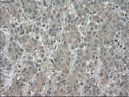 NTRK3 / TRKC Antibody (clone OTI2B8)