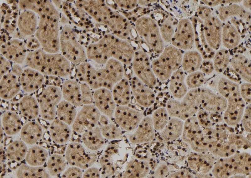 Polyclonal Rabbit anti-Human SCNM1 Antibody (IHC, WB)