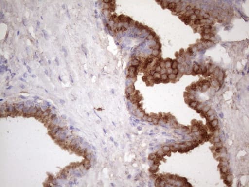KLK3 / PSA Antibody (aa25-261, clone OTI1F7)