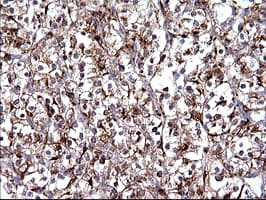 SCAMP2 Antibody (clone OTI3C2)