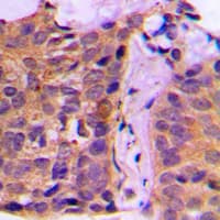 Polyclonal Rabbit anti-Human YWHAZ / 14-3-3 Zeta Antibody (Internal, IHC, IF, WB)