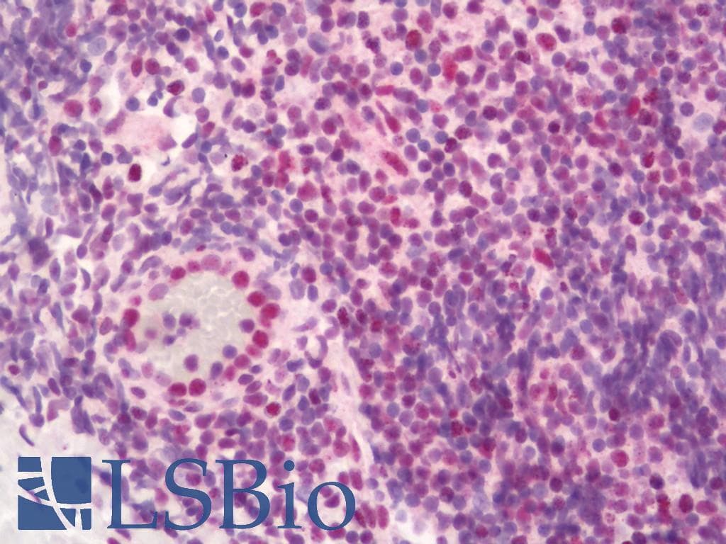 IHC-plus™ HSF1 Antibody (aa267-315)