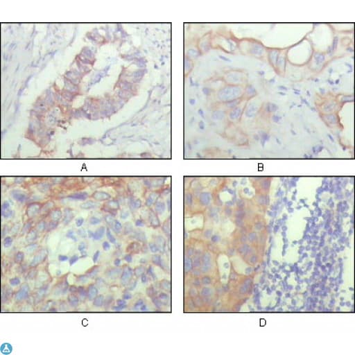 ALCAM / CD166 Antibody