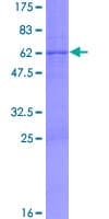 Human UNG / Uracil DNA Glycosylase Protein (Recombinant GST)