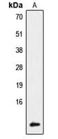 Polyclonal Rabbit anti-Human NDUFA4 Antibody (C-Terminus, IHC, IF, WB)