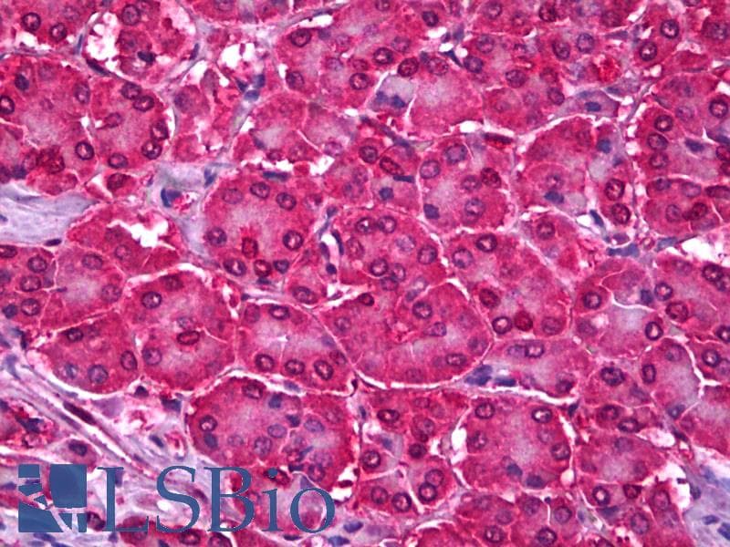 IHC-plus™ Polyclonal Goat anti-Human UBE2I / UBC9 Antibody (aa2-14, IHC, WB)