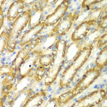 IHC-plus™ TM9SF1 Antibody