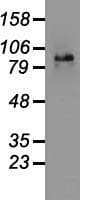 CTNNB1 / Beta Catenin Antibody (clone OTI2D11)