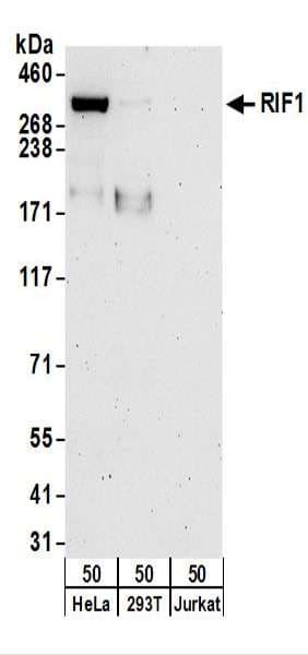 IHC-plus™ RIF1 Antibody (aa2425-C-term)