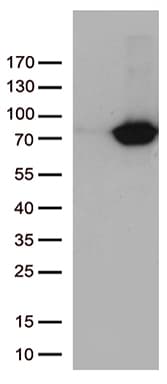 Monoclonal Mouse anti-Human TGM2 / Transglutaminase 2 Antibody (clone OTI4H5, IHC, WB)