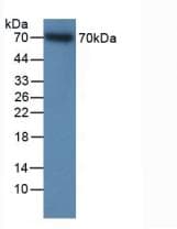 ITGB2 / CD18 Antibody (aa451-627, APC)