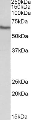 IHC-plus™ GGT1 / GGT Antibody (aa27-40)