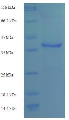 Human IL2 Protein (Recombinant GST)
