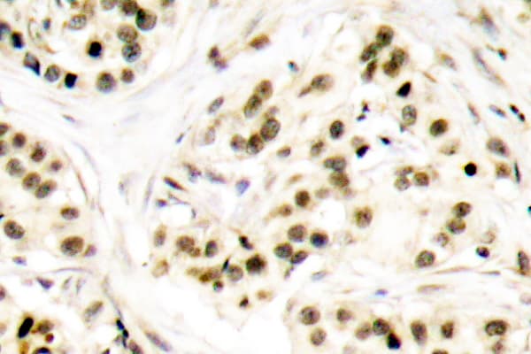 CHEK2 / CHK2 Antibody (phospho-Thr68)