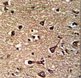 Polyclonal Rabbit anti-Human GLRX2 / Glutaredoxin 2 Antibody (aa120-146, IHC, WB)