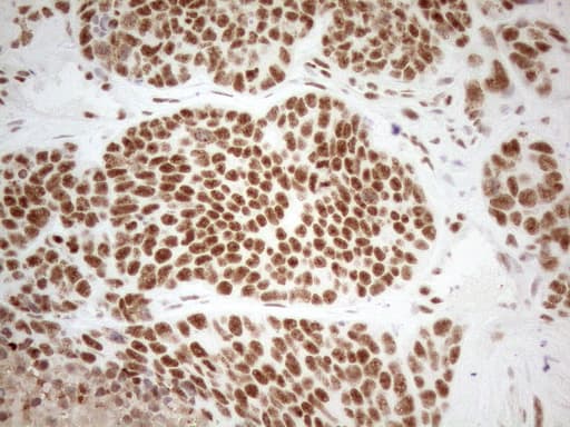 Monoclonal Mouse anti-Human WTAP Antibody (clone OTI12G7, aa2-106, IHC, WB)