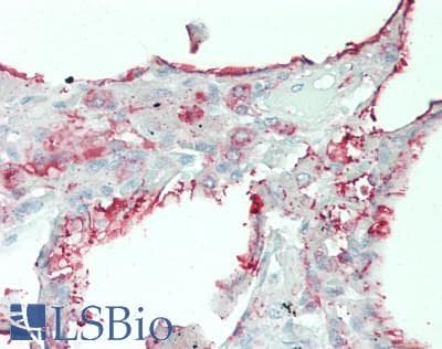 IHC-plus™ Polyclonal Rabbit anti-Human COL4A2 / Collagen IV Alpha2 Antibody (aa156-186, IHC, WB)