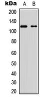 KIF11 / EG5 Antibody (C-Terminus)