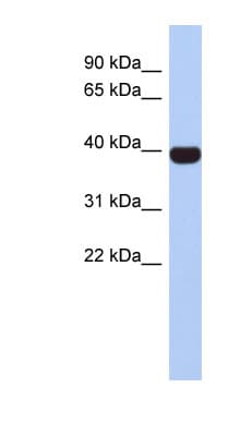 NEUROD4 Antibody (aa215-264)