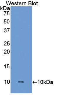 HPSE / Heparanase Antibody (aa280-412, APC)