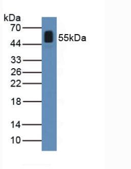 ANGPTL2 / ARP2 Antibody (aa267-493)
