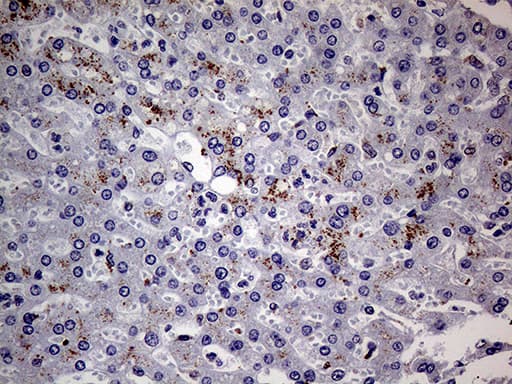 ALDP / ABCD1 Antibody (aa508-745, clone OTI3A1)