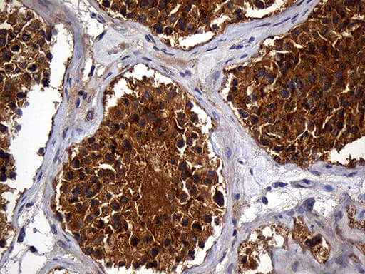 Gravin / AKAP12 Antibody (aa266-557, clone OTI1B6, Carrier-free)