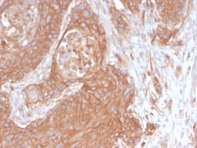 SPTBN2 Antibody (aa356-475, clone SPTBN2/2894R, Azide-free, Carrier-free)