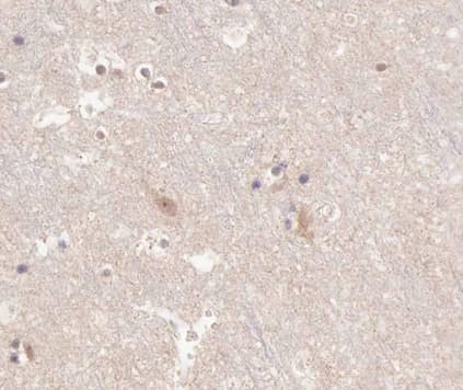 KCNC2 / Kv3.2 Antibody