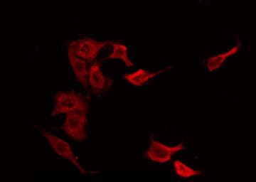 CGB / hCG Beta Antibody (aa122-148)