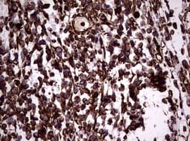 Vimentin Antibody (clone OTI5C10)